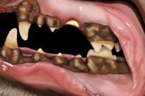 Η πλάκα καταστρέφει τον ιστό των ούλων και στη συνέχεια και τους άλλους ιστούς που στηρίζουν τα δόντια (όπως οι σύνδεσμοι και το οστό της γνάθου).
