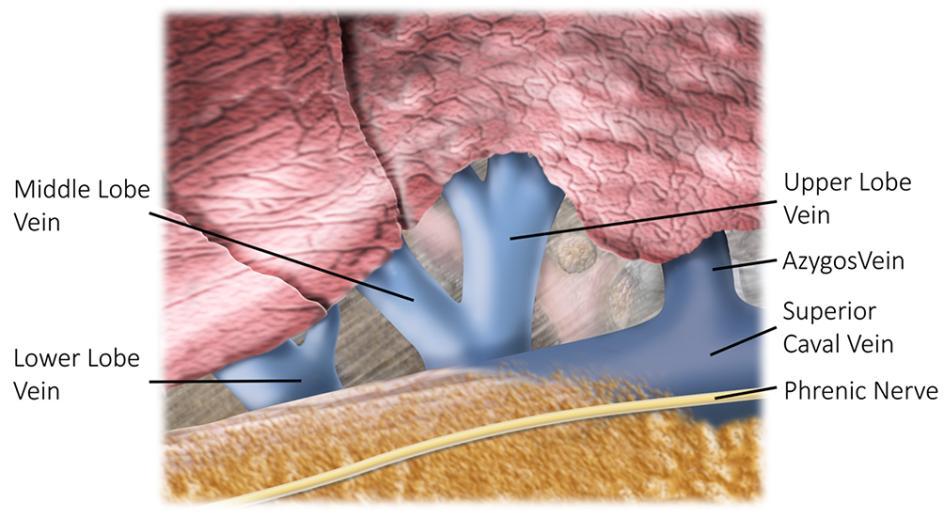 Fissure first