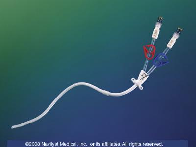 Peripherally Inserted Central Catheters (PICCs) Εμφυτεύσιμα
