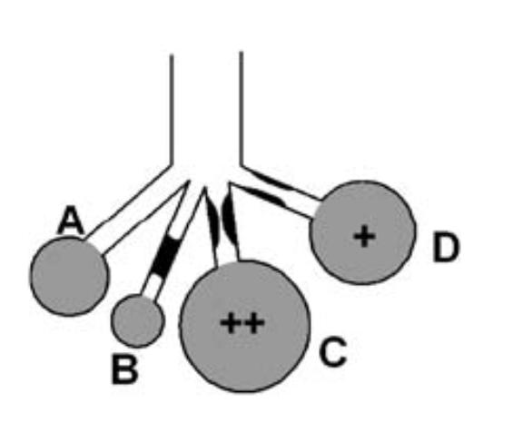 Asthma: heterogeneous respiratory