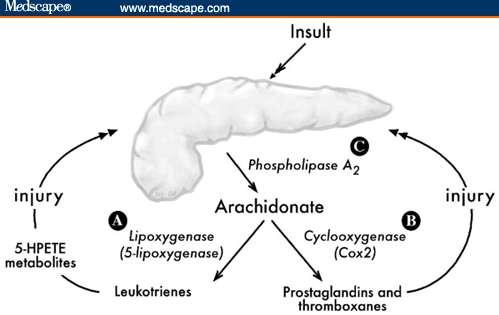 Acute pancreatitis Βλάβη που οδηγεί σε διαφυγή των παγκρεατικών ενζύμων εντός του