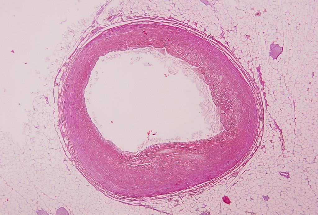 2.4 ΒΛΑΒΗ