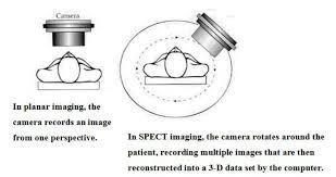 SPECT: Single photon emission computed tomography SPECT: Απεικονίζει κάθε περιοχή