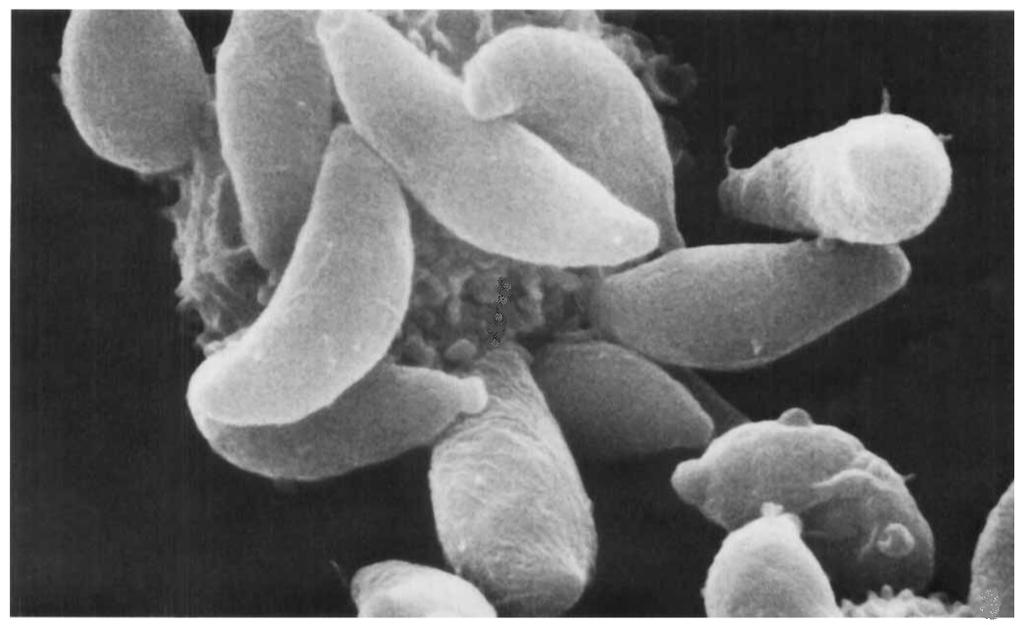 [60]. Ο βιολογικός κύκλος του Toxoplasma gondii εμφανίζει τρεις μολυσματικές