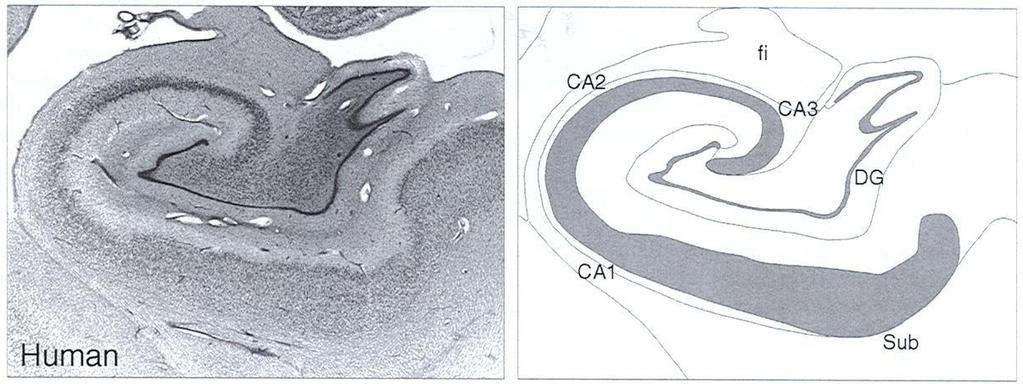 CA2 CA 3 CA4 DG CA1 Κύριες κυτταρικές ομάδες της δομής του Ιπποκάμπου CA = Cornu Amonis - Ammon's horn - Αμμώνιο