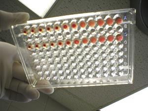 Αιμοσυγκόλληση με συστήματα μικροπλακών 96-well plate Εαν υπάρξουν συμπλέγματα