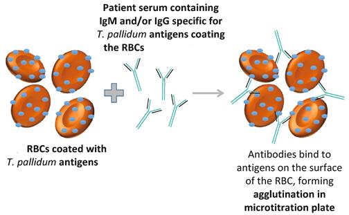 Αρχή της μεθόδου Μονιμοποιημένα ερυθροκύτταρα πτηνών επιστρώνονται με τμήματα του T. pallidum που έχουν αντιγονικές ιδιότητες.