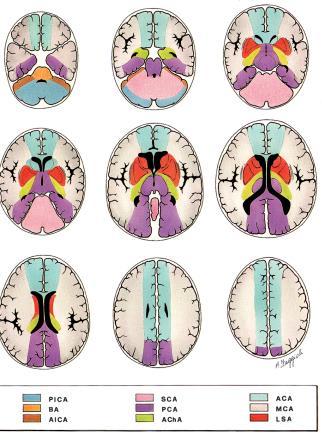 Savoiardo M: The vascular territories of the carotid and vertebrobasilar