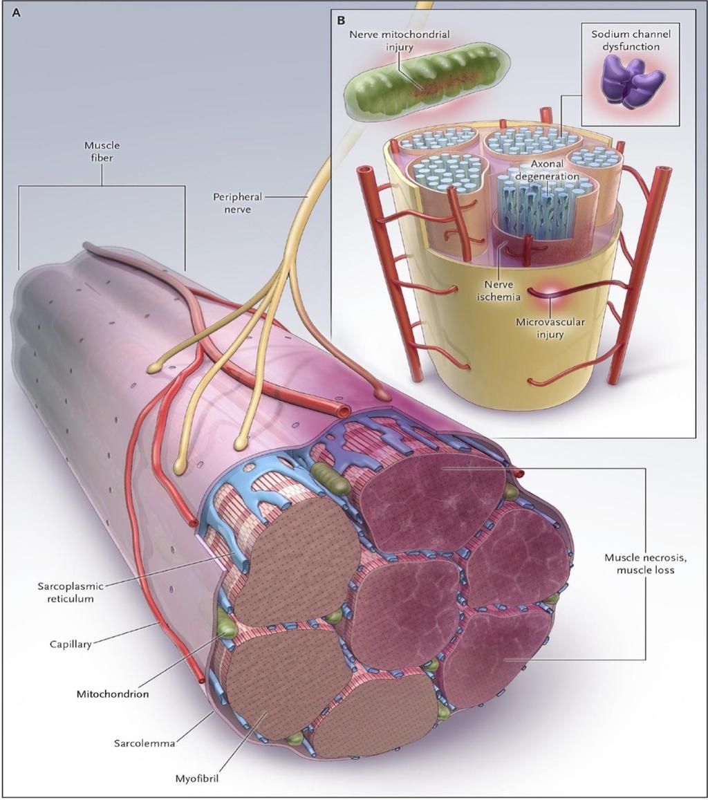 NEJM