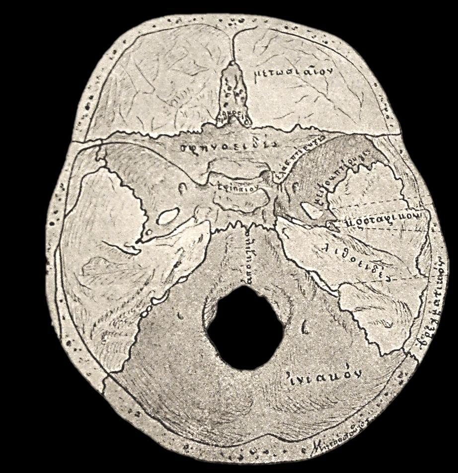 Πρόςκιοσ κρανιακόσ βόκροσ: τοίχωμα μετωπιαίου
