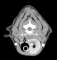 Canine thyroid tumours being able to differentiate between benign and malignant tumours.