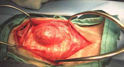 Venous drainage is through the cranial thyroid vein, which drains into the jugular vein. 44-45 Figure 8.