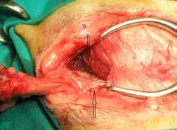 Transpelvic urethrostomy in cats Figure 4. Elliptical incision of the skin and blind dissection of subcutaneous tissue in TPU.