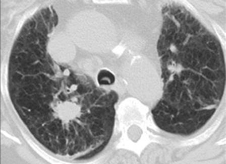 Diagnostic approach to the solitary