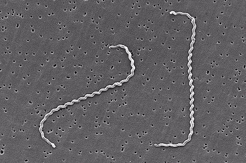 Coccidiodes immitus, Histoplasmosis)