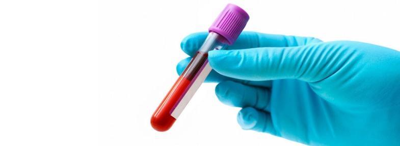 Τρόποι αντιμετώπισης α) In vitro δοκιμασίες (