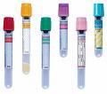 Εργαστηριακός Έλεγχος Γενική εξέταση αίματος (Αιμοσφαιρίνη, Αιματοκρίτης, Ερυθρά, Λευκά, Αιμοπετάλια, ΤΚΕ) Ουρικό Οξύ c-αντιδρώσα πρωτεΐνη (CRP) (Σε υποψία λοίμωξης) Ασβέστιο, Φωσφόρος, Αλκαλική
