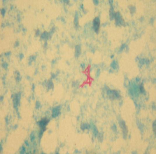 Οικογένεια: Mycobacteriaceae Γένος : Mycobacterium M. tuberculosis complex M.
