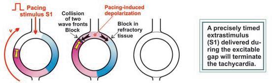 TERMINATION OF REENTRANT