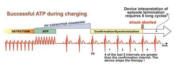 Προσοχή: Μία θεραπεία ATP μπορεί δυνητικά να οδηγήσει σε νέα ταχύτερη VT!