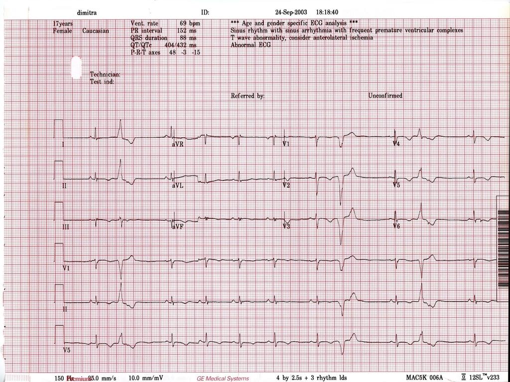 PVCs