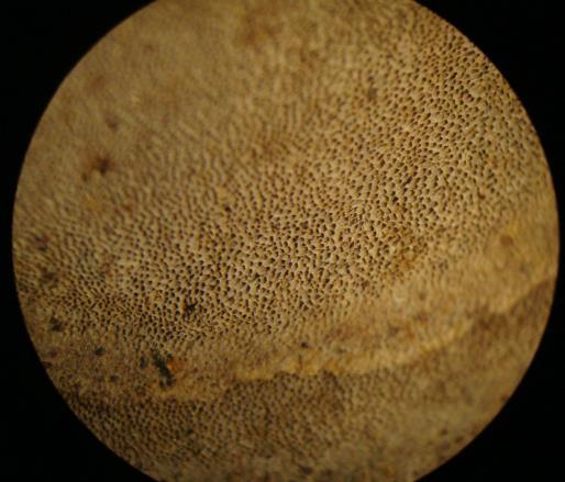 29-30: Συμπτώματα ίσκας σε βραχίονες της ελιάς. Εικ.