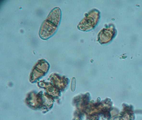 5-6: Κονίδια του παθογόνου Cycloconium oleagineum.