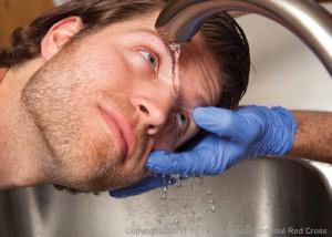 ΠΡΩΤΕΣ ΒΟΗΘΕΙΕΣ(6) Χημικά εγκαύματα: Στο πρόσωπο θέλουν μεγάλη προσοχή ρίχνετε νερό με τρόπο ώστε να μην οδηγήσουμε το