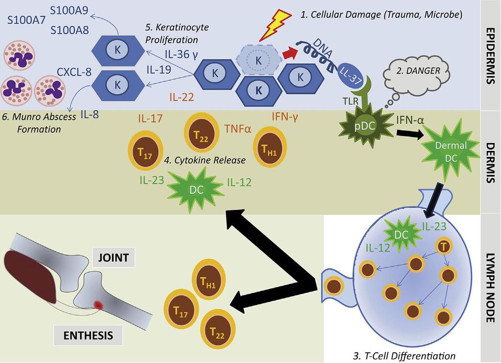 ρέζε δέξκαηνο θαη ςσξηαζηθήο λόζνπ 5 Υπερπλαςία κερατινοκυττάρων 1 Κυτταρική καταςτροφή (τραφμα μικρόβιο) 2.