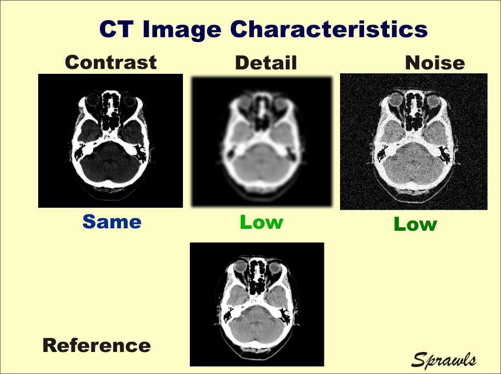 Ποιότητα εικόνας CT : Χαρακτηριστικά εικόνας Γενικά, στην CT η αντίθεση εικόνας ή η contrast sensitivity μίας διαδικασίας δεν εμφανίζει σημαντική εξάρτηση από τη δόση.