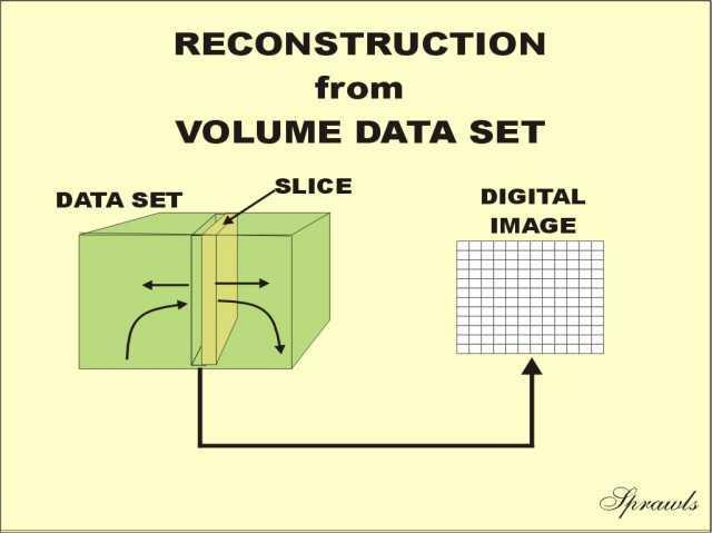 Ελικοειδής-σπειροειδής σάρωση - Ανακατασκευή Με την ελικοειδή σάρωση, οι τομές ορίζονται κατά τη διάρκεια της ανακατασκευής και όχι κατά τη διάρκεια της λήψης δεομένων.