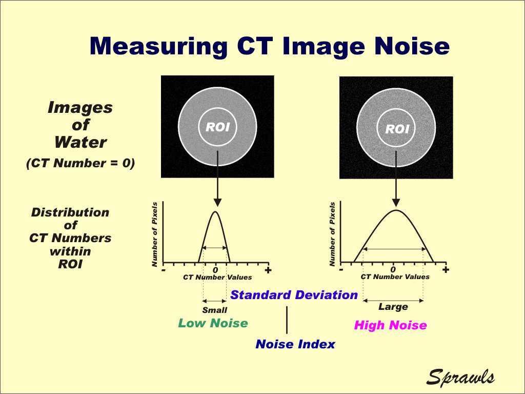 Υπολογισμός θορύβου εικόνας Ο υπολογισμός του θορύβου εικόνας πραγματοποιείται χρησιμοποιώντας το λογισμικό (software) του συστήματος και ειδικά ομοιώματα που συνοδεύουν το σύστημα.