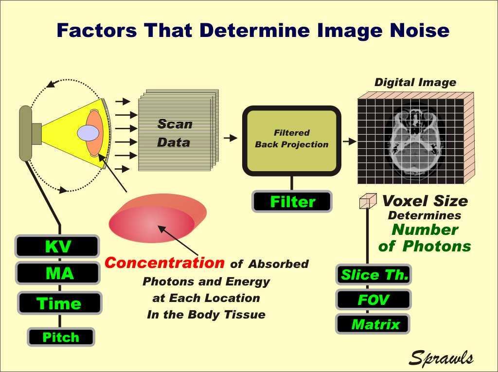Παράγοντες που επηρεάζουν το θόρυβο εικόνας During the scanning phase the same factors we introduced earlier as those that affect dose also have an effect on noise because they control the