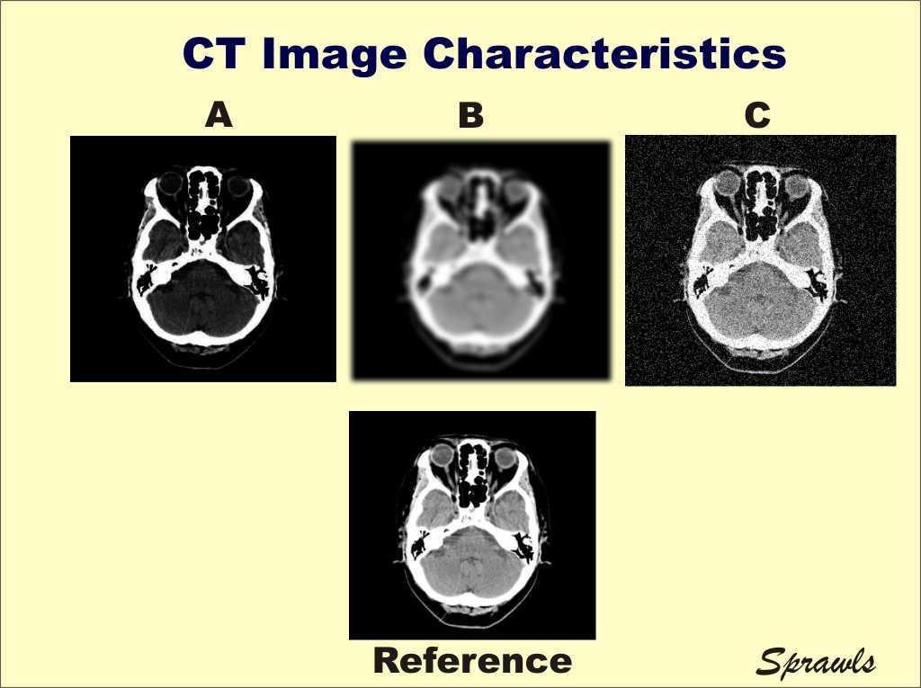 Ποιότητα εικόνας CT : Χαρακτηριστικά εικόνας Τα σημαντικότερα χαρακτηριστικά που επηρεάζουν την