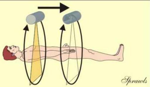 ne is the rotation of the x-ray tube and x-ray beam around the body to produce many different "views" thought the body.