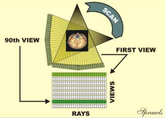 From each x-ray tube position it typically projects a thin, fanshaped beam through the patient's body. After passing thought the body the beam in intercepted by an array of radiation detectors.