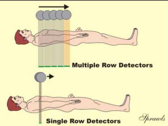 The major advantage of multiple-row detectors is they produce multiple, parallel views in each tube position which increases the speed of collecting scan data along the patient's body.