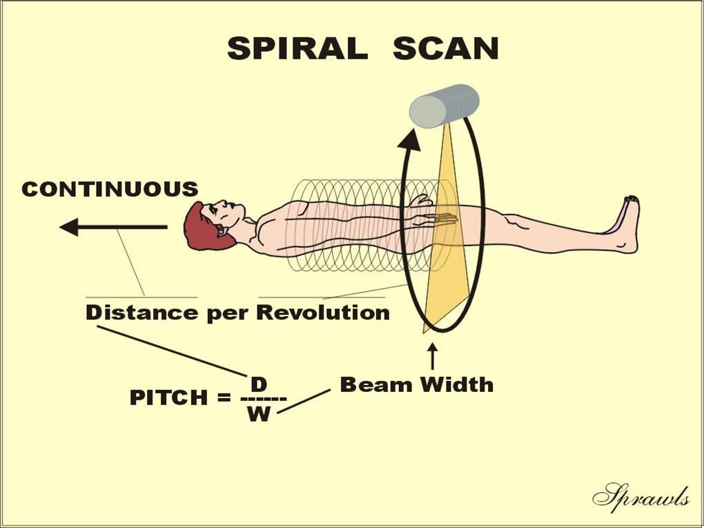 Spiral or Helical Scanning The preferred alternative for many procedures is the helical or spiral scanning method shown here.