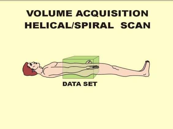 The data set is continuous over the anatomical area scanned and not divided into individual slices as with the scan and step method described above.