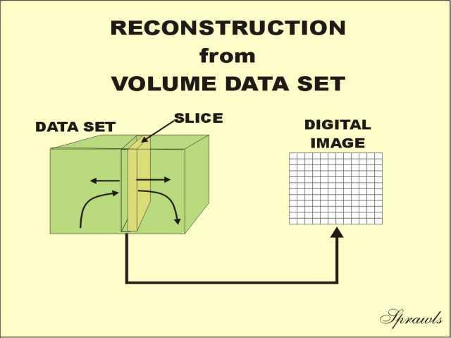 With spiral scanning the slices are determined at the time of reconstruction, not at the time of the scanning and data It is possible to go back and reconstruct images for different slice