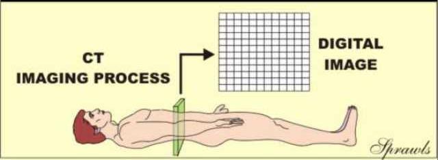 Ανακατασκευή εικόνας - Voxels CT image reconstruction is a mathematical process for converting the scan data into a digital image of a specific anatomical area.