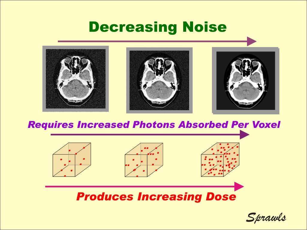 Ρύθμιση θορύβου εικόνας The noise in an image comes from statistical errors in the measurement of the CT numbers of each tissue voxel.