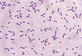 Παράγοντες που πρέπει να ληφθούν υπόψη Ο Streptococcus pneumoniae και ο