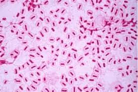 Mycoplasma pneumoniae προκαλεί σποραδικές επιδημίες Σε περιόδους επιδημίας