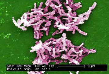 2.Το είδος Clostridium difficile 2.1 Εισαγωγή Το Clostridium difficile αποτελεί ένα Gram-θετικό, αναερόβιο βακτήριο που έχει την ικανότητα να παράγει ενδοσπόρια.