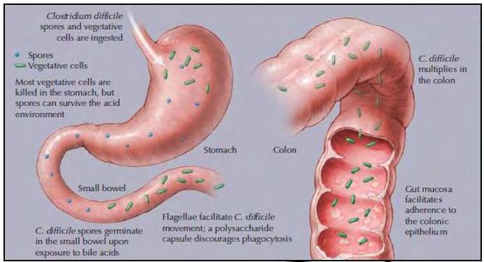 Η λοίμωξη ξεκινά όταν το C. difficile εισέρχεται στον ξενιστή από το περιβάλλον διαμέσου της γαστρεντερικής οδού.