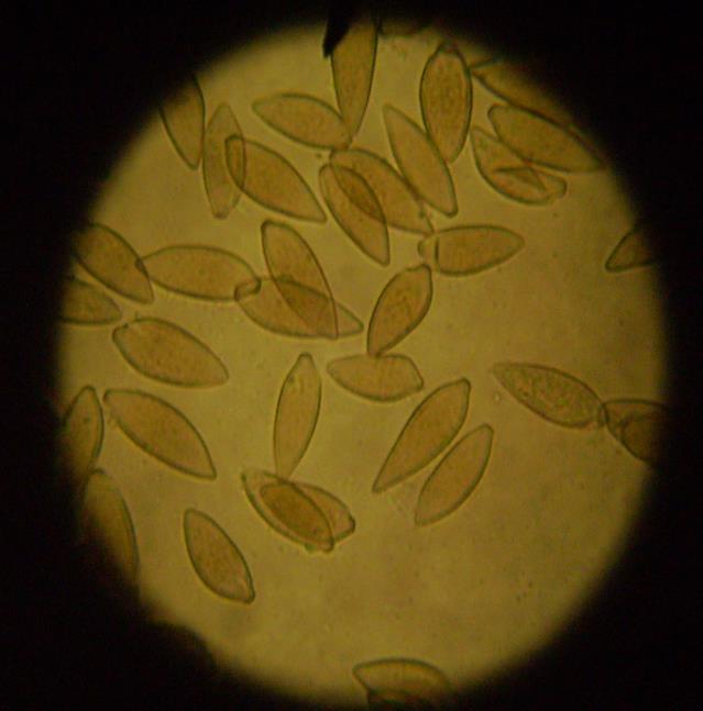 ΑΙΤΙΟ-ΣΥΝΘΗΚΕΣ ΑΝΑΠΤΥΞΗΣ Η ασθένεια προκαλείται από τον ασκομύκητα Venturia inaequalis (Pleosporales, Venturiaceae), με ατελή μορφή του μύκητα Fusicladium