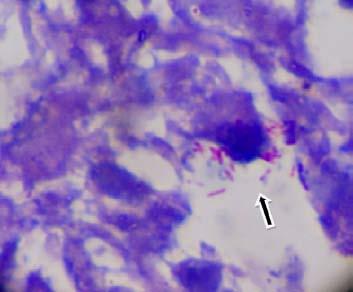 για B-Koch: Ζ-Ν: