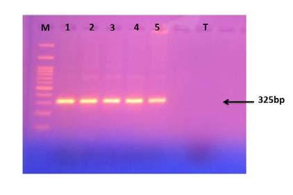 Ενδεικτικά παρουσιάζεται μια εικόνα ηλεκτροφόρησης των PCR προϊόντων τα οποία εμπεριέχουν τον πολυμορφισμό rs10434