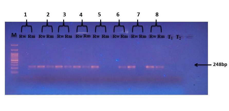 4.3 Μελέτη του πολυμορφισμού rs3024997 Για τη γονοτύπηση των δειγμάτων ως προς τον πολυμορφισμό rs3024997 χρησιμοποιήθηκε η μέθοδος της Allele Specific-PCR.
